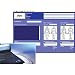 Intelect Legend XT Patient Data Management System for Intelect Legend XT System