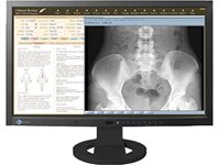 Eizo MS230W-BK 58,4 cm (23 Zoll) Widescreen LCD Monitor, DVI-D, VGA (Kontrast 3000:1, 7ms  Preisvergleich