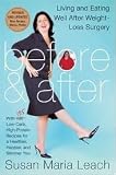  : Before & After, Revised Edition: Living and Eating Well After Weight-Loss Surgery 1 Revised edition