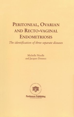 Endometriosis