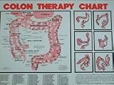 Colon Therapy Chart, By Dr. Norman Walker