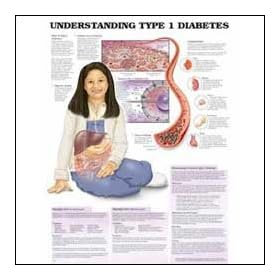 Understanding Type 1 Diabetes Anatomical Chart 20" X 26" Laminated