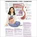 Understanding Type 1 Diabetes Anatomical Chart 20