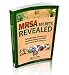 31A%2BSxfTvhL. SL75  MRSA Books