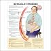 Metabolic Syndrome Anatomical Chart 20