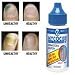 Mycocide Nail Solution