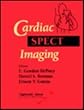 Cardiac SPECT Imaging