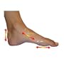 Tandem LiquidCell Blister Bands - 6 Pack