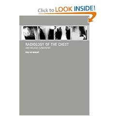 Radiology of the Chest and Related Conditions by F W Wright