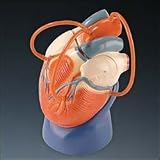 Life Size Heart Model Coronary Bypass Edition