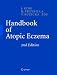 Handbook of Atopic Eczema 31BS1fR6SyL. SL75 Baby Eczema