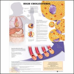 high cholesterol
