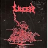 Ulcer