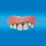 Big Cletus Billy Bob Teeth