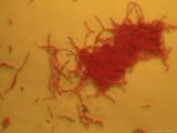 Anthrax, Photomicrograph, Spores Photos To Go Collection Photographic Poster Print by Kent Wood, 48x36