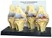 osteoarthritis49  - GPI 4Stage Anatomical Human Osteoarthritis Knee Model