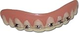 Billy-Bob Teeth - Braces