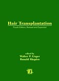  : Hair Transplantation, Fourth Edition