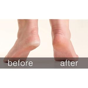 Arquivo Pedicure Rio Pé Heel rápida Smoother Elétrica