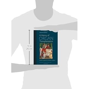 A History of Organ Transplantation: Ancient Legends to Modern Practice