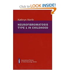 Neurofibromatosis Type I in Childhood by E. Fernández-Alvarez