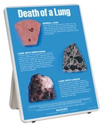 Death of a Lung Easel Display