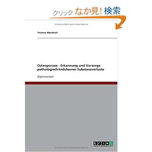 【クリックでお店のこの商品のページへ】Osteoporose. Erkennung Und Vorsorge Pathologisch-Knocherner Substanzverluste: Thomas Mansholt: 洋書