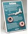 Asthma Easel Display