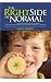 The right side of normal :