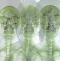 Supergrass