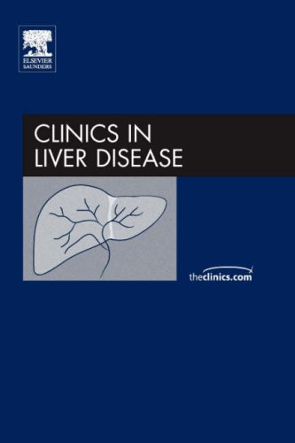 Liver Transplantation, An Issue of Clinics in Liver Disease (The Clinics: Internal Medicine) under Hepatology in The Books Store