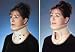 * Collar Height 4 1/4 * In 1983 the Tracheotomy Philadelphia© Collar was introduced an innovative cervical collar with high-quality materials that provided an unparalleled combination of immobilization and patient comfort * The unique trachea opening allows healthcare professionals the ability to quickly perform carotid pulse monitoring and emergency tracheotomies while providing cervical immobilization * Every product we manufacture demonstrates our commitment to patient compliance and recovery through superior immobilization and comfort * Restricts cervical spine flexion extension and rotation to promote patient recovery * * Latex-free non-toxic and hypoallergenic Plastazote© foam reduces skin irritation * Adjustable bilateral Velcro© hook and loop fasteners ensure proper fit * Anterior and posterior rigid plastic reinforcement supports limit movement * Large trachea opening for quick access to carotid pulse monitoring and emergency tracheotomies * Two-piece design enhances patient comfort * Total cervical arch support maintains neutral alignment of the cervical spine * Conformance to the shoulder and mandible contour allows superior stability and comfort * Ventilation openings reduce heat and moisture * Maneuverable chin support for airway management * * Water-resistant for bathing and aqua-therapy * Easily customized for individual requirements * X-ray CT and MRI lucent * * Clean with mild soap and water * *