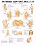 `Arthritis / Joint Chart 20