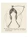 Experiment Devised by Luigi Galvani Showing Movement of Frog Legs Due to Electrical C...
