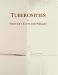 Tuberosities: Webster's Facts and Phrases