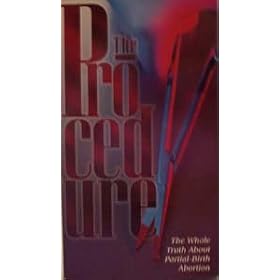 The Procedure [VHS Tape] (1996)