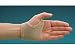 Replacement Gel Shell Pad, Size: Small For Rolyanel Shell Splint Left This is an accessory for the Rolyanel Shell Splint Left Only. Rolyanel Shell Splint Left is sold separately. Product photo may not exactly match the product offered for sale. Please refer to the product description.