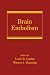 Books : Brain Embolism (Neurological Disease and Therapy)
