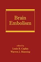 Brain Embolism (Neurological Disease and Therapy)
