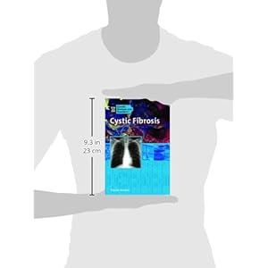 Cystic Fibrosis (Genetic & Developmental Diseases & Disorders)