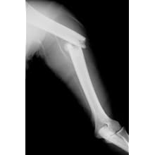Edvotek 138 The Biochemistry of Osteoporosis, For 10 Groups