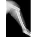 Edvotek 138 The Biochemistry of Osteoporosis, For 10 Groups