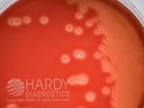 GBS Detect, for non-hemolytic Group B Strep (Pack of 10)