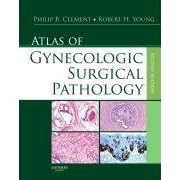 Atlas of Gynecologic Surgical Pathology (Atlas Of...) by  Philip B. Clement and Robert H. Young