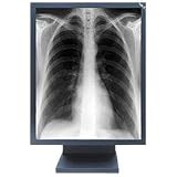 NEC MultiSync MD21GS-2MP-BK-CB2 - Flat panel display - 2MP - grayscale - TFT - 21.3 - 1600 x 1200 - 900 cd/m2 - 700:1 - 35 ms - 0.27 mm - DVI-D, VGA