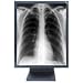 Electronics : NEC MultiSync MD21GS-2MP-BK-CB2 - Flat panel display - 2MP - grayscale - TFT - 21.3" - 1600 x 1200 - 900 cd/m2 - 700:1 - 35 ms - 0.27 mm - DVI-D, VGA