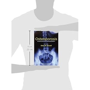 Osteoporosis: Diagnosis and Management