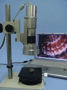 Microscope Video Zoom by Flexbar