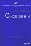 Cancer du Sein Cancer du Sein