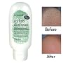 Be Natural Dry Heel Eliminator 4 oz.